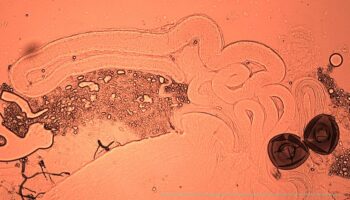 Eyacular durante el sexo o la masturbación mejora la calidad del semen