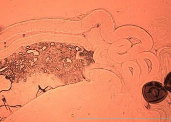 Eyacular durante el sexo o la masturbación mejora la calidad del semen