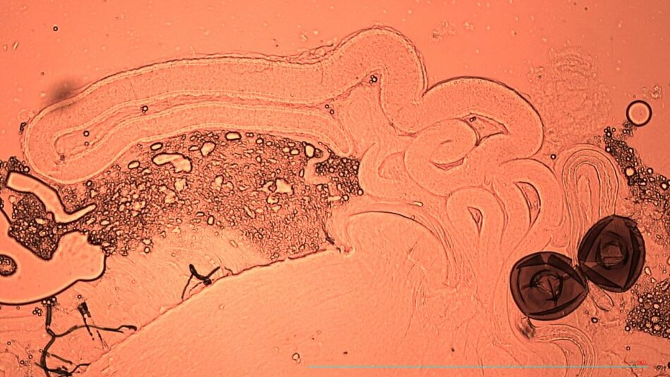 Eyacular durante el sexo o la masturbación mejora la calidad del semen