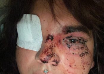 La Plataforma Trans condena la brutal agresión de una mujer trans en la que casi pierde un ojo