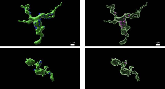 La fertilidad está relacionada con las células inmunitarias del cerebro