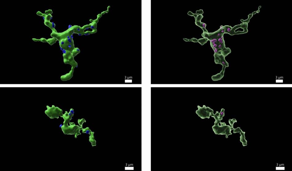 La fertilidad está relacionada con las células inmunitarias del cerebro