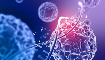 Logran reprogramar células inmunitarias contra el cáncer dentro del organismo