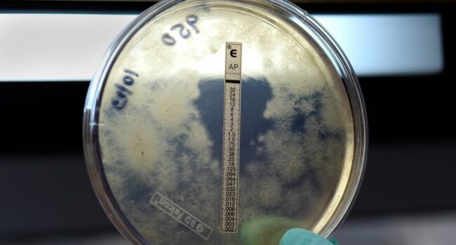 Meningitis B: qué saber tras el brote en Reino Unido y la situación en España