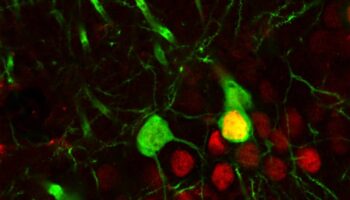 Recaer en el consumo de cocaína no es falta de voluntad: la droga reconfigura el cerebro