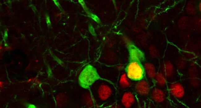Recaer en el consumo de cocaína no es falta de voluntad: la droga reconfigura el cerebro