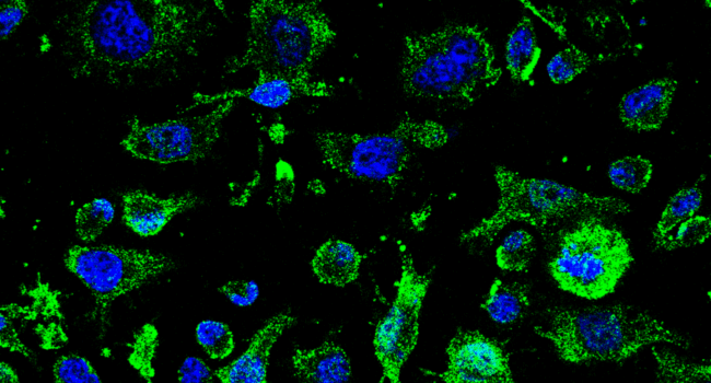 Un fármaco del CSIC contra la ELA recibe la autorización de la AEMPS para iniciar su ensayo clínico