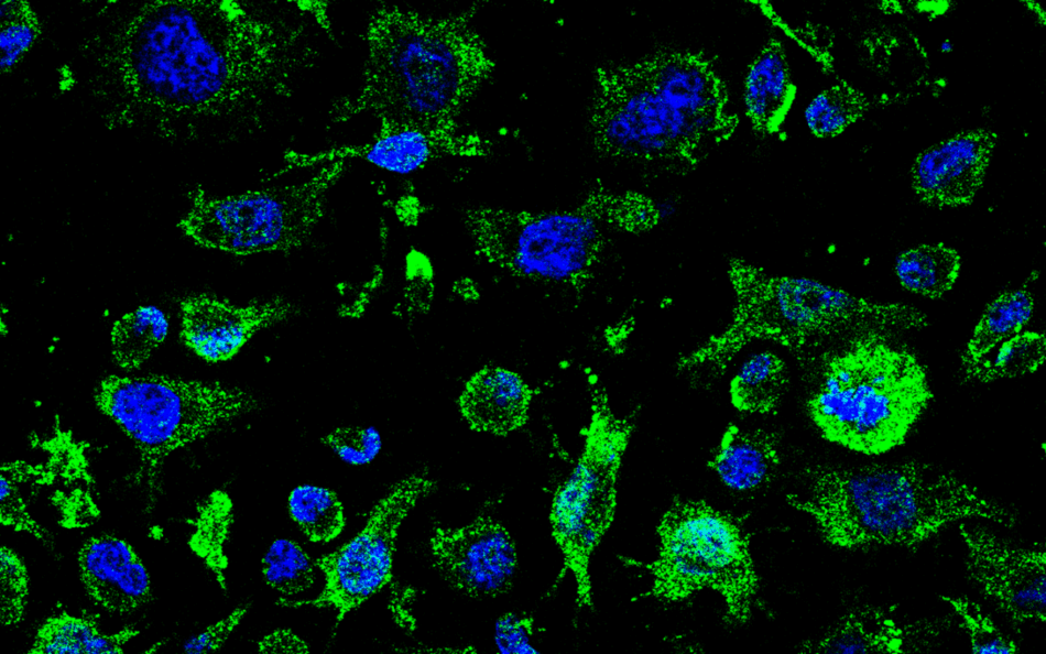 Un fármaco del CSIC contra la ELA recibe la autorización de la AEMPS para iniciar su ensayo clínico