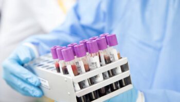 Primer caso de ‘curación’ del VIH con un trasplante de células madre procedente de un hermano