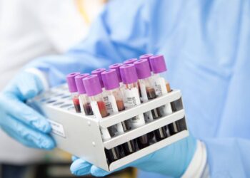 Primer caso de ‘curación’ del VIH con un trasplante de células madre procedente de un hermano