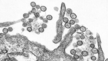 Expertos desmienten bulos sobre el hantavirus: ni es nuevo ni es como la covid