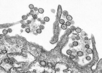 Expertos desmienten bulos sobre el hantavirus: ni es nuevo ni es como la covid