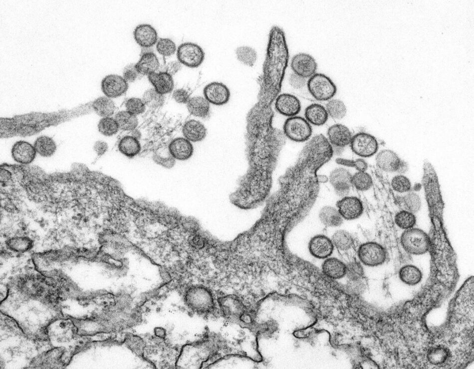 Expertos desmienten bulos sobre el hantavirus: ni es nuevo ni es como la covid
