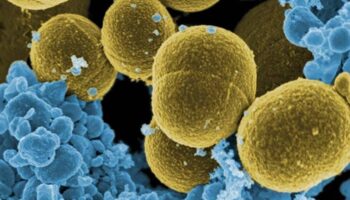 Las bacterias más ‘pegajosas’ pueden causar infecciones menos severas