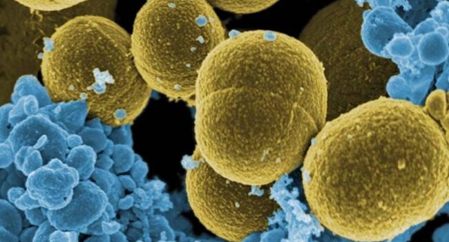 Las bacterias más ‘pegajosas’ pueden causar infecciones menos severas