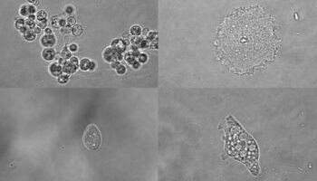 La vida conserva un lenguaje común para activar los genes, pero no para silenciarlos