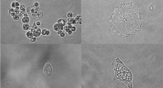 La vida conserva un lenguaje común para activar los genes, pero no para silenciarlos