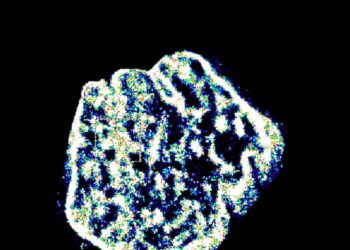 Sondas fluorescentes permiten obtener imágenes del ADN con una resolución insólita
