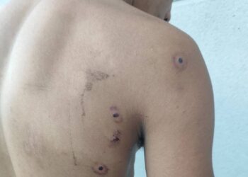 CGT denuncia situación en Ceuta y exige medidas urgentes contra la crisis humanitaria