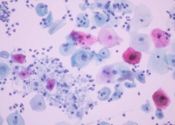 Desarrollan un sistema de IA para detectar una de las infecciones sexuales más frecuentes del mundo